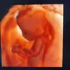 Avatar wmoles