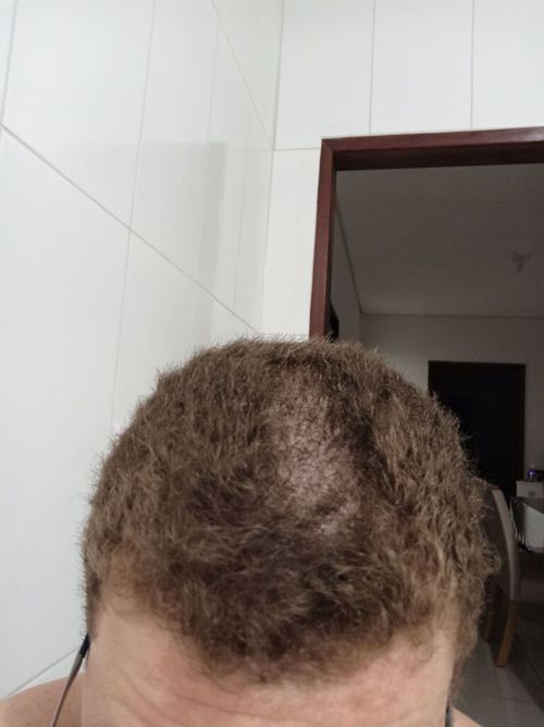 6981182-NpRyD.jpg