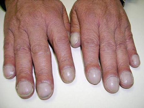4826779-kxDNL.jpg